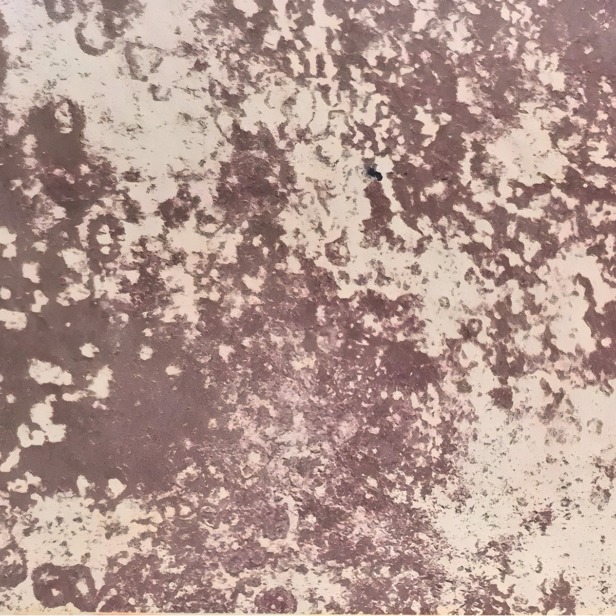 NEOSKIN | Midas Mocha